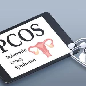 PCOS Treatment