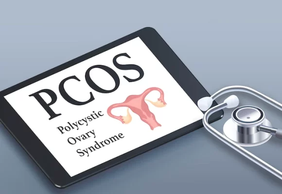 PCOS Treatment